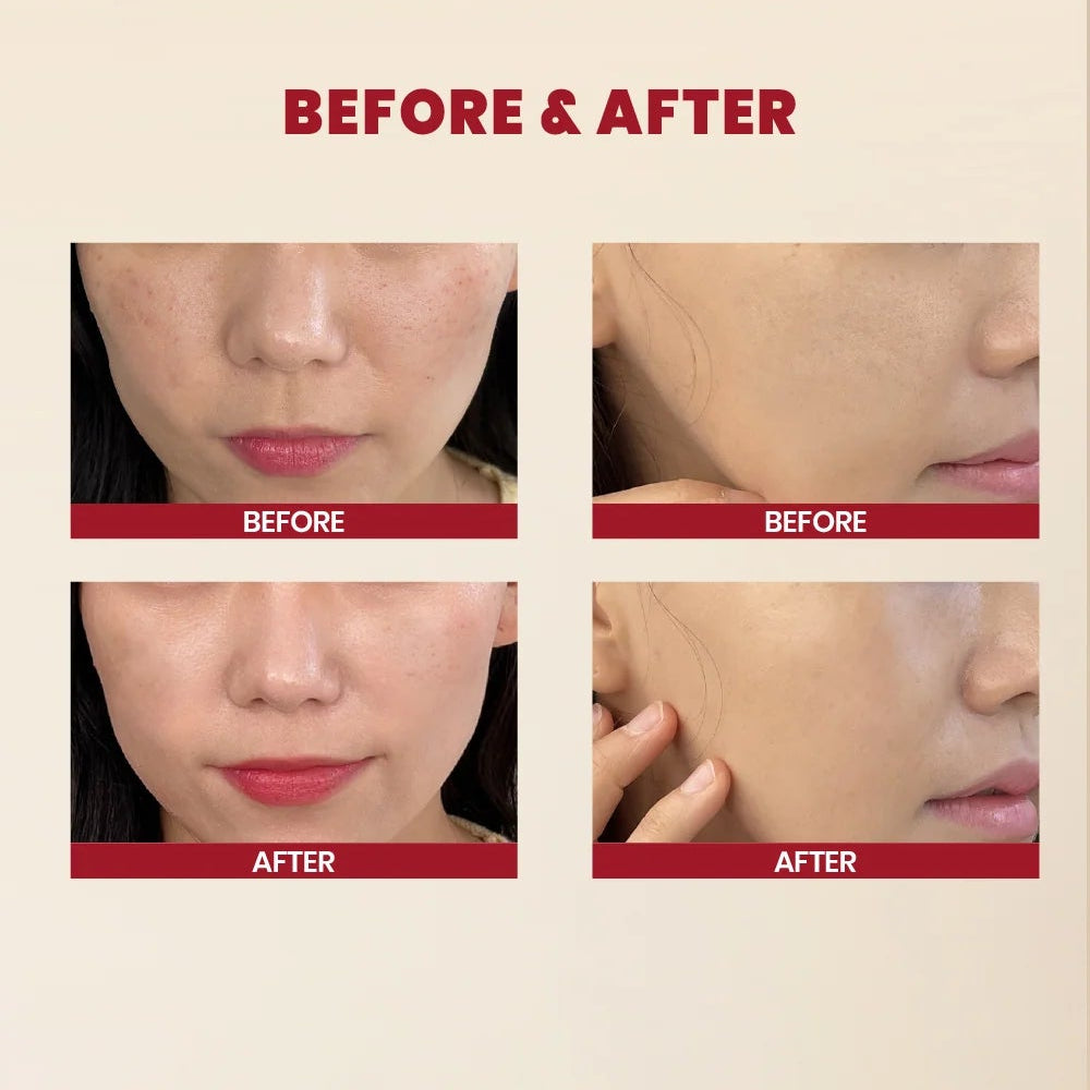 KSECRET - Sérum Facial SEOUL 1988 Essence : 97% Baba de Caracol + Arroz