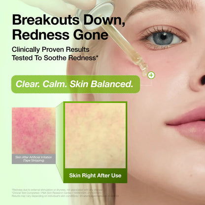 ANUA - Azelaic Acid 10 Hyaluron Redness Soothing Serum